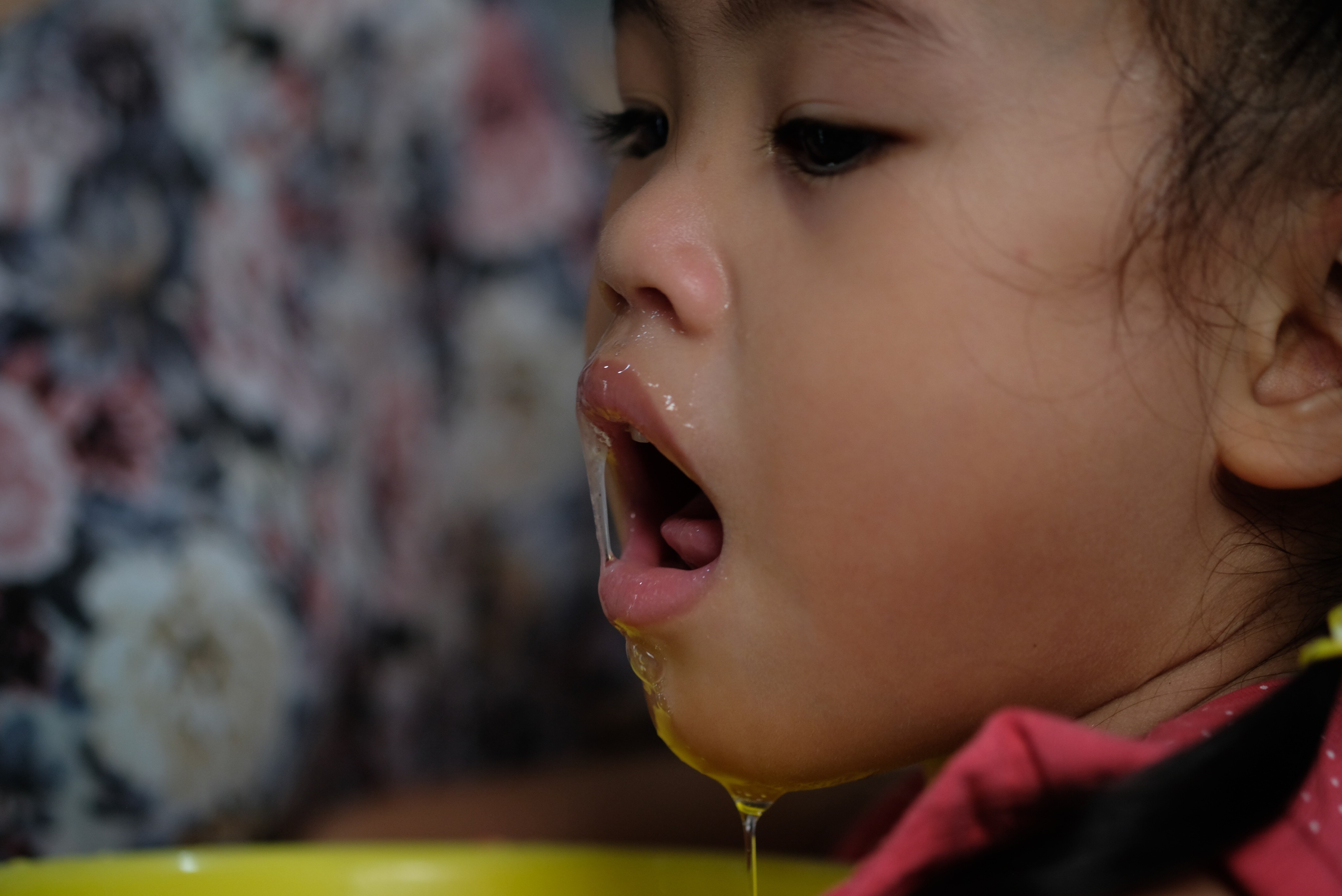 anak sering ngeces, penyebab anak ngeces, cara mengatasi anak ngeces, bayi ngeces berlebihan, ngeces karena tumbuh gigi, gangguan pencernaan anak, masalah oral motorik, cara merawat kesehatan mulut anak